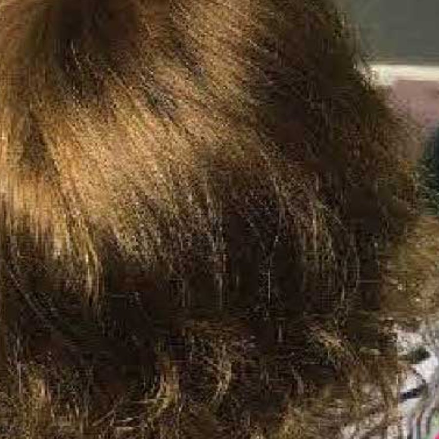 After: hairline and crown restored with a New Me piece