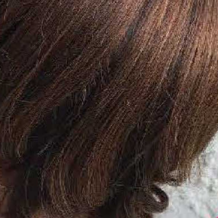 After: thinning crown restored with a hair topper